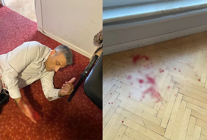 Öztürk Yılmaz’ı bıçaklayan şahıs, internette ‘adam öldürmenin’ cezasını aratmış!