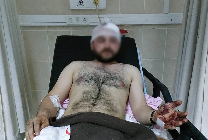 Aile kavgasını kana bulamıştı…