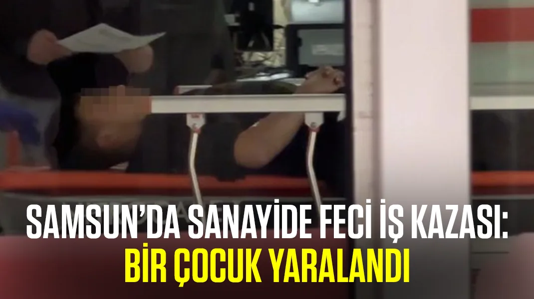 Samsun’da sanayide feci iş kazası: Bir çocuk yaralandı