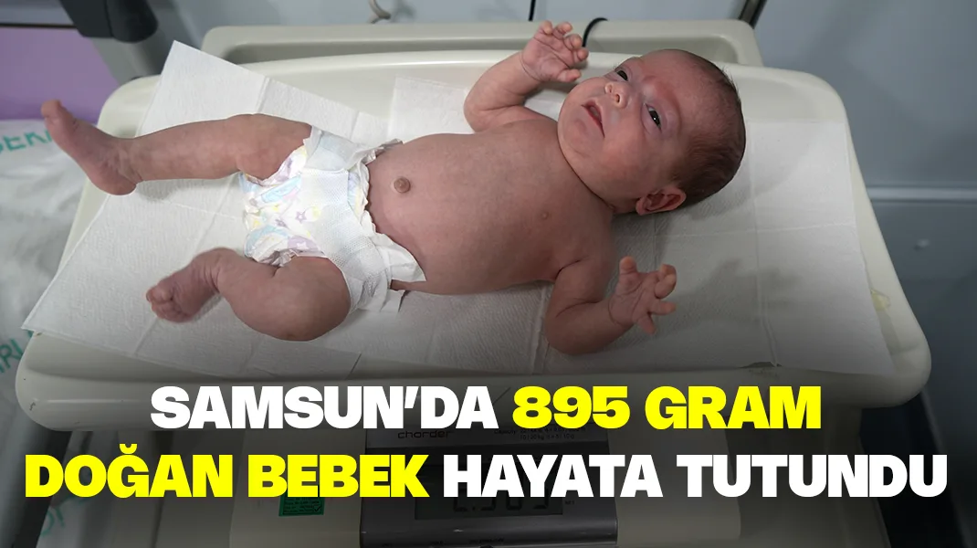 Samsun’da 895 gram doğan bebek hayata tutundu