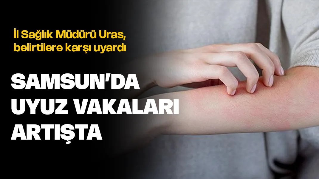 Samsun’da uyuz vakaları arttı